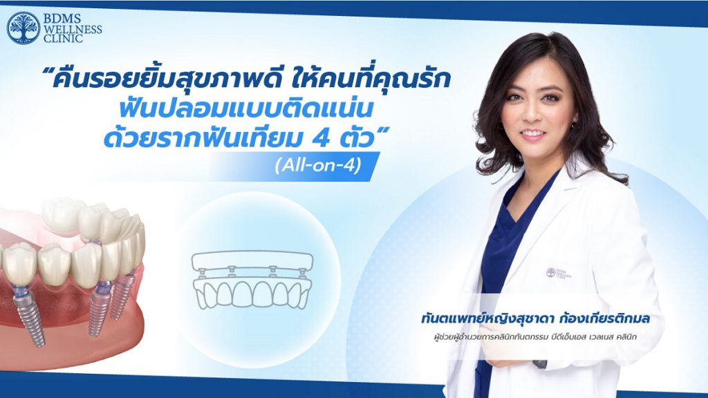“รากฟันเทียม” All-on-4 ปลดล็อกปัญหาฟัน เติมเต็มความมั่นใจให้กับผู้สูงวัย    